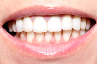 Sana-dent-teeth-after-8062