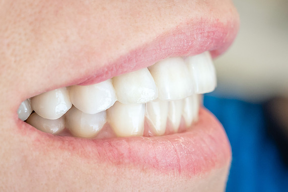 Sana-dent-teeth-after-8025